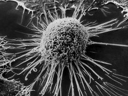 Раковите клетки имат колективно съзнание