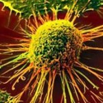 Кошмарът настъпва: Заболеваемостта от рак се увеличава драстично по целия свят!